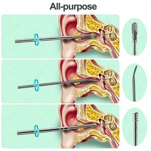6-in-1 Stainless-Steel Ear Cleaning Tool Kit (1 Pc)