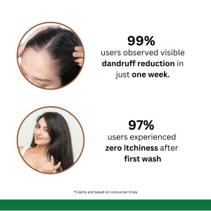 Anti Dandruff Shampoo for Itch Control & Scalp Care (200 ml)